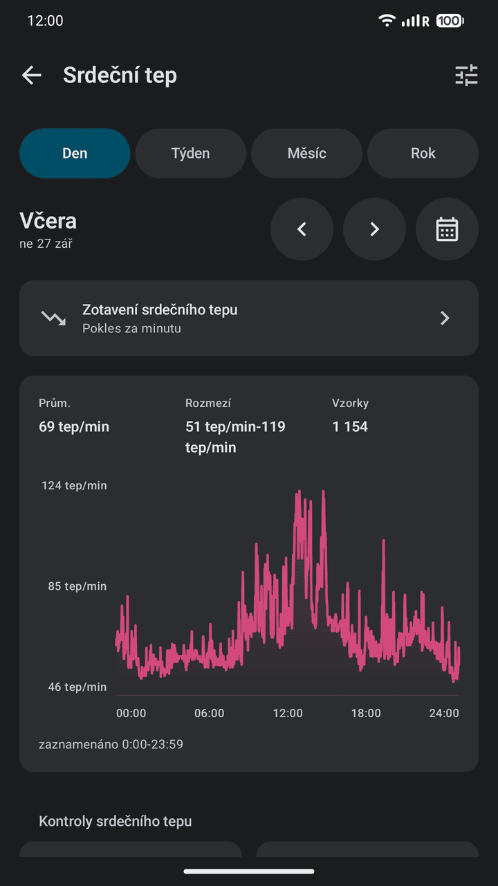 OpenVitals: Srdeční tep