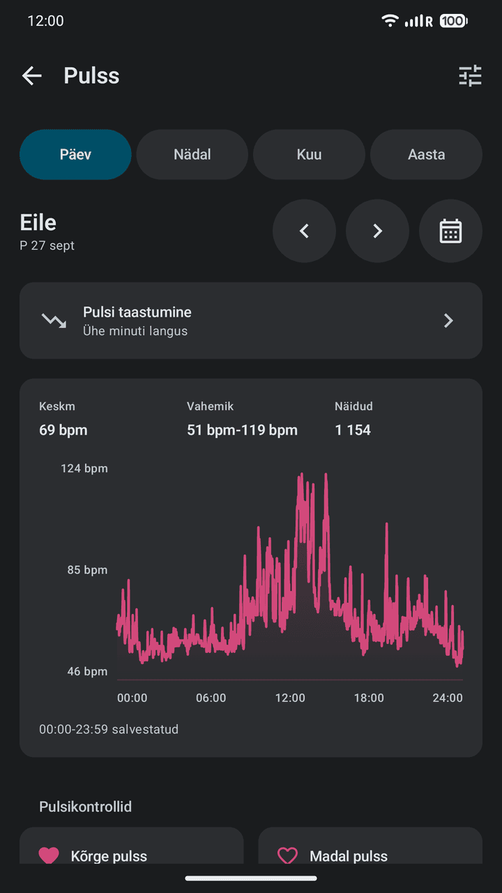 OpenVitals: Pulss